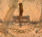 Harpactea hombergi - female cleared genitalia (c) ZFMK spider course 2005
